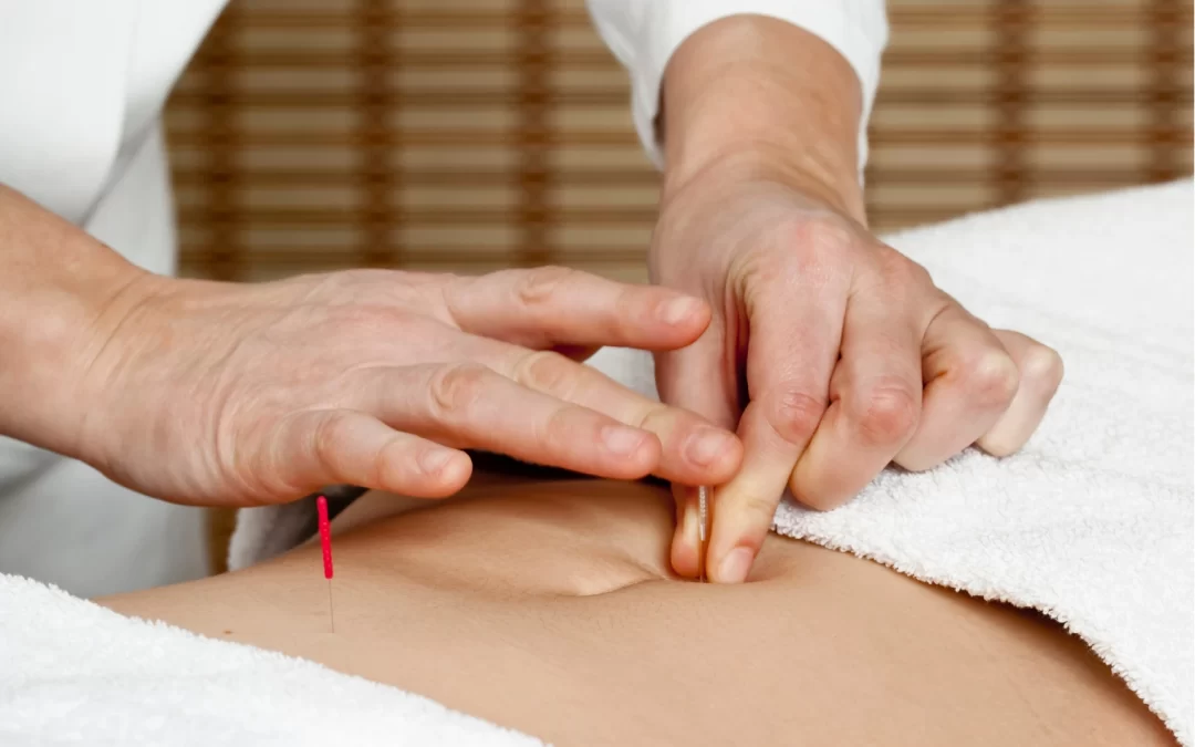 Trying to Conceive? How Fertility Acupuncture in Beverly Hills Can Support Your Journey