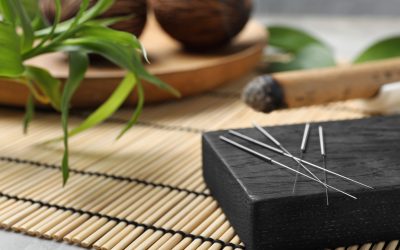 Stressed Out? Here’s Why Acupuncture Might Be Just What the Doctor Ordered