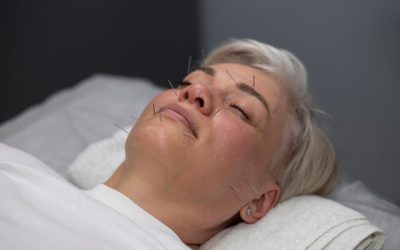 How Acupuncture May Help Relieve TMJ Discomfort and Jaw Tension